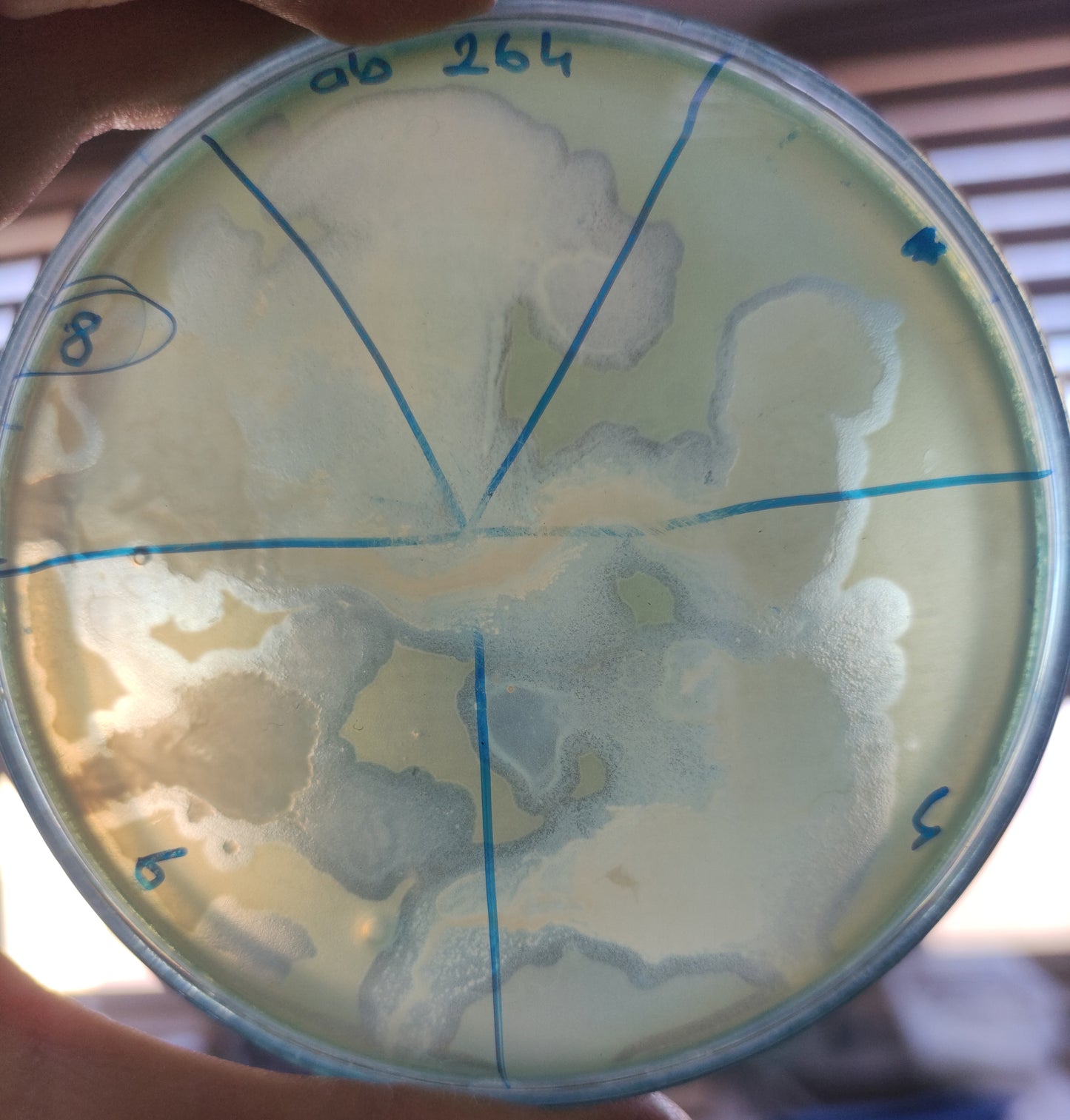 Acinetobacter baumannii bacteriophage 120264A