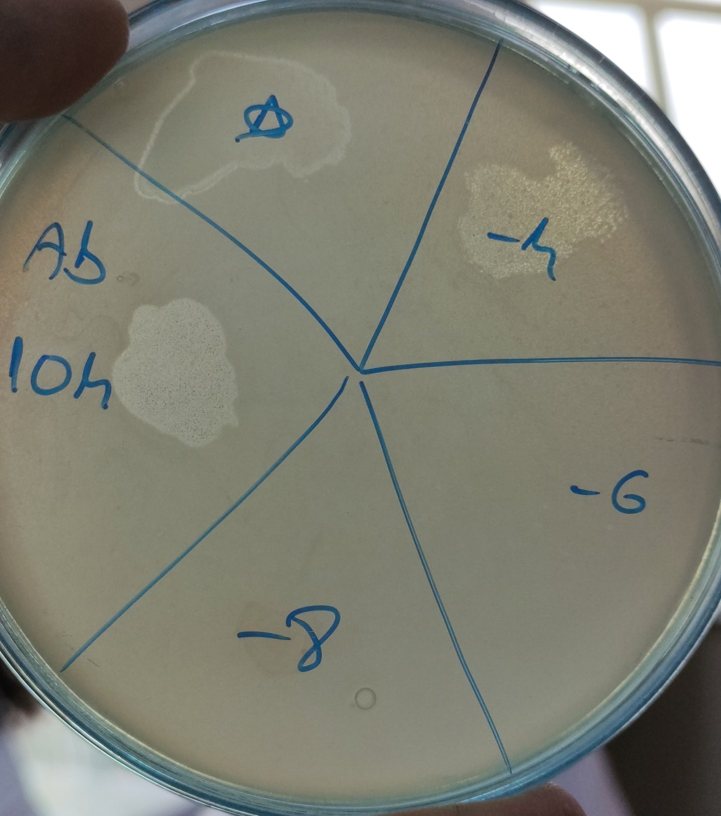 Acinetobacter baumannii bacteriophage 120104A