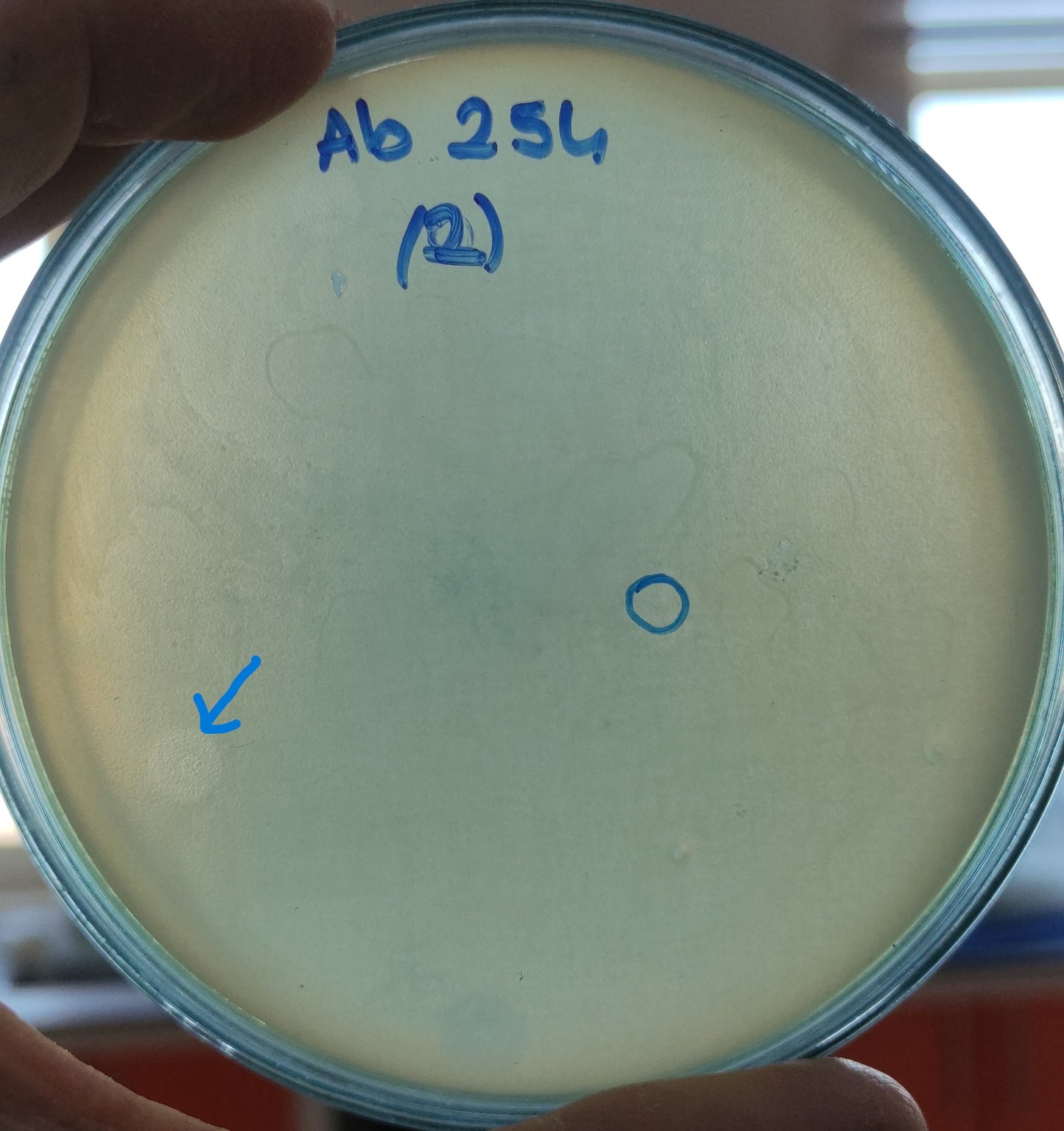 Acinetobacter baumannii bacteriophage 120254A