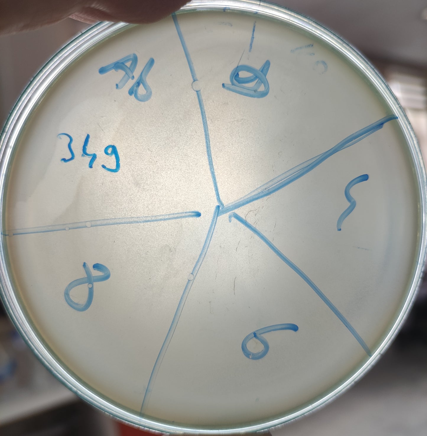 Acinetobacter baumannii bacteriophage 120349A