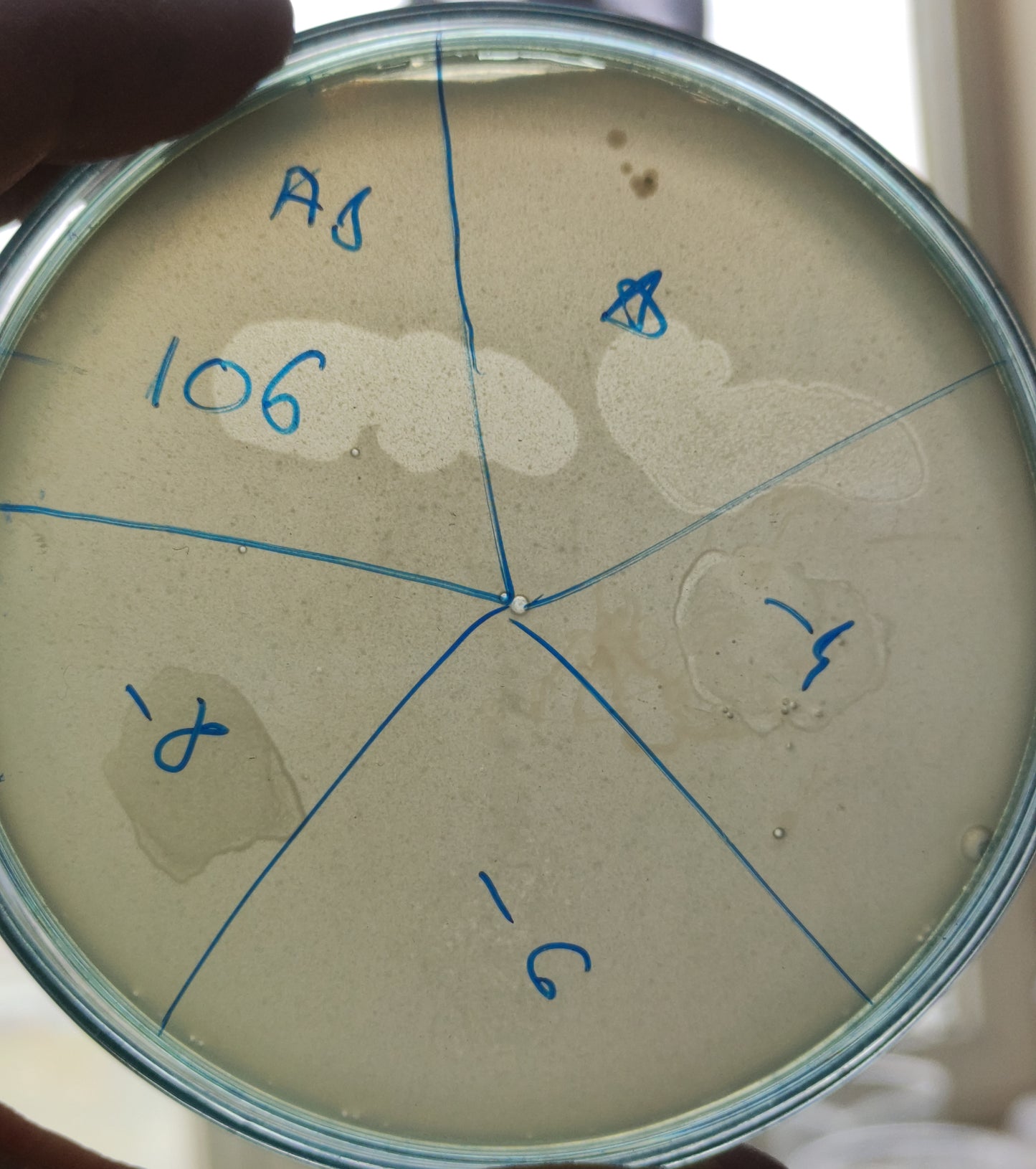 Acinetobacter baumannii bacteriophage 120106A