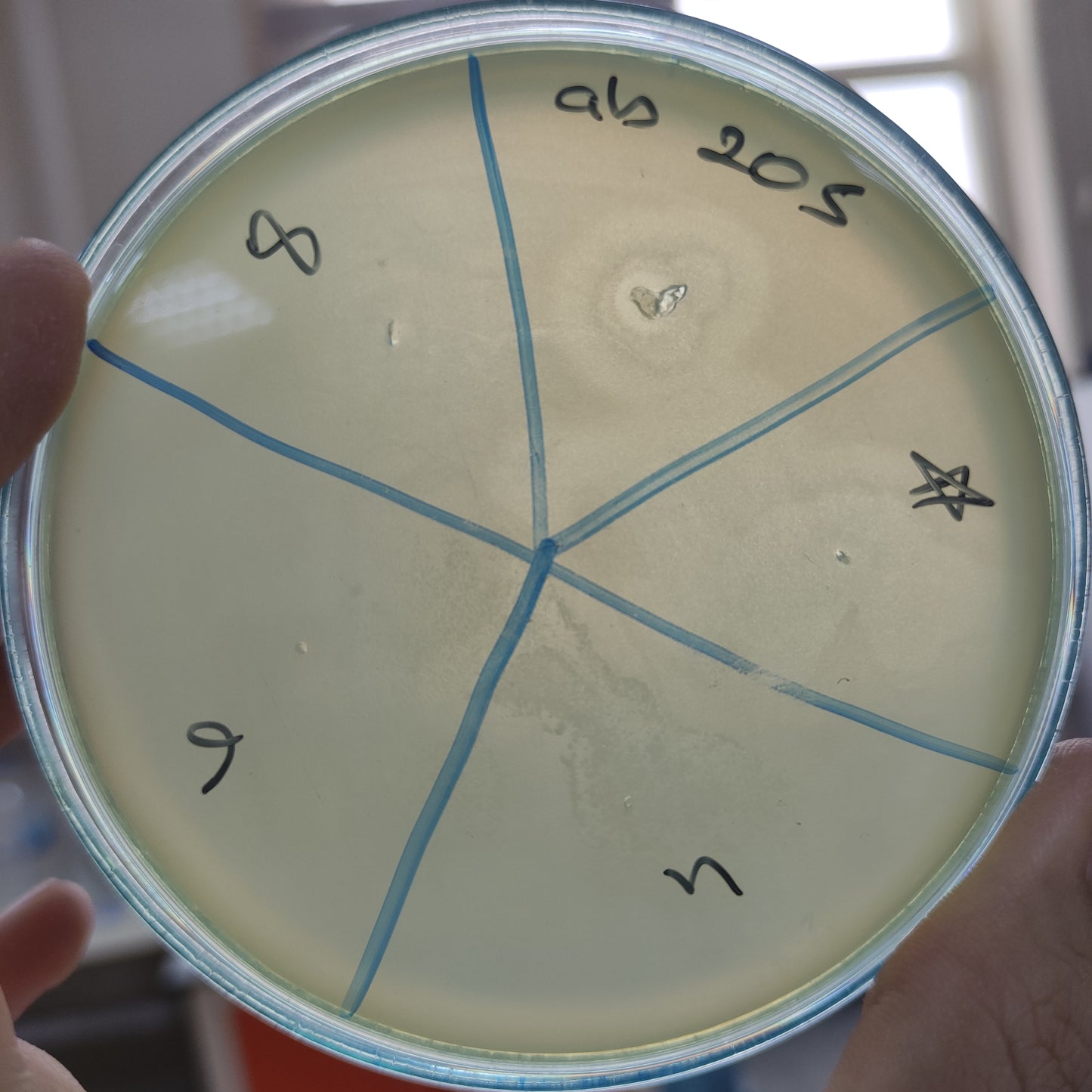 Acinetobacter baumannii bacteriophage 120205A