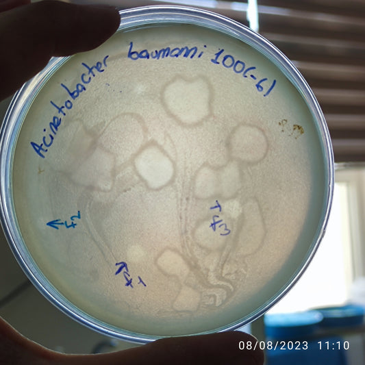 Acinetobacter baumannii bacteriophage 120100F