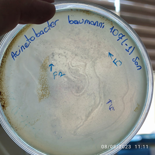 Acinetobacter baumannii bacteriophage 120107F