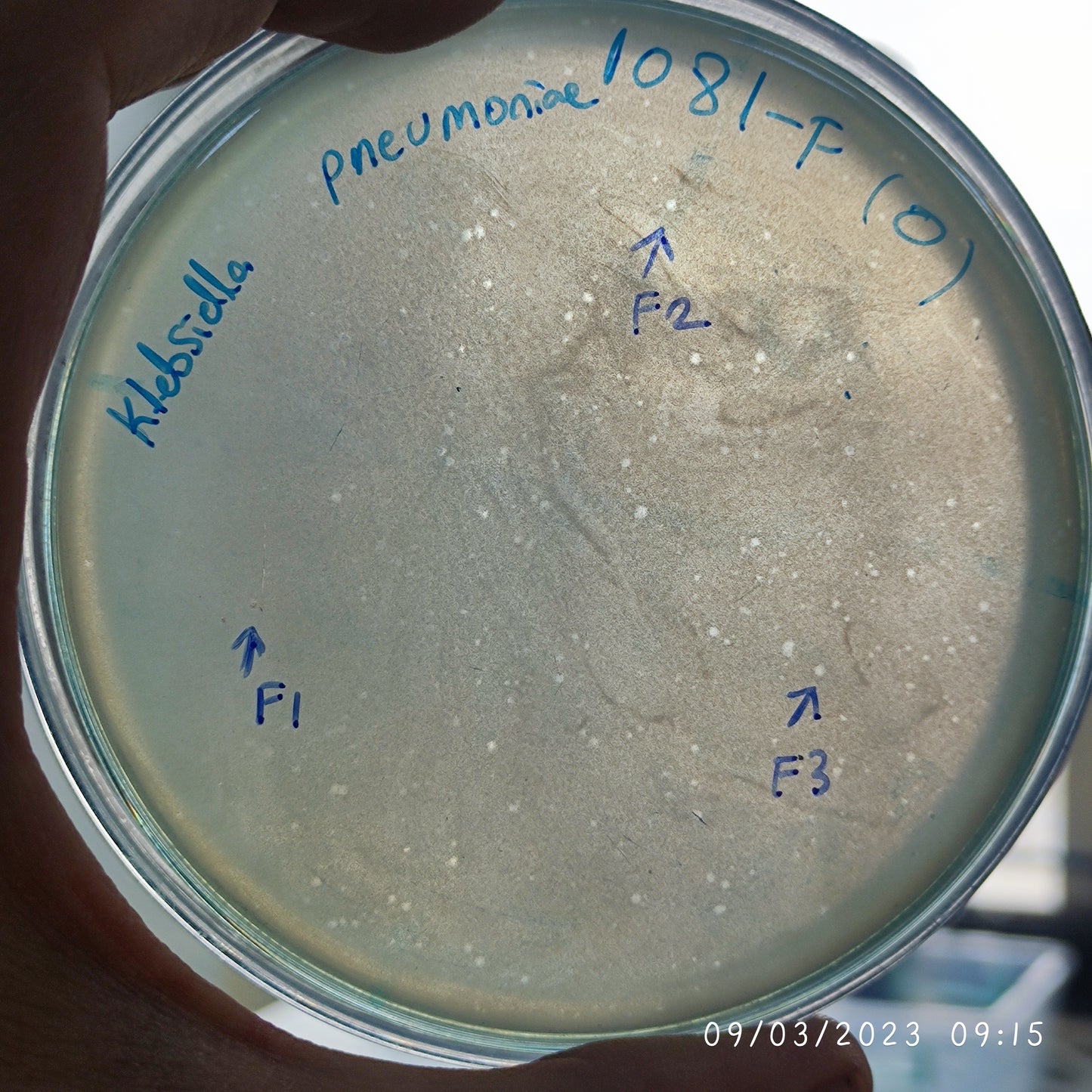 Klebsiella pneumoniae bacteriophage 181081F