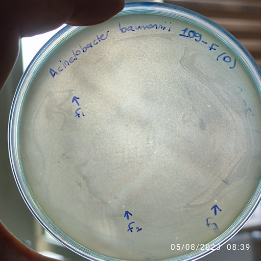 Acinetobacter baumannii bacteriophage 120109F