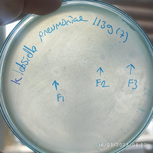 Klebsiella pneumoniae bacteriophage 181139F