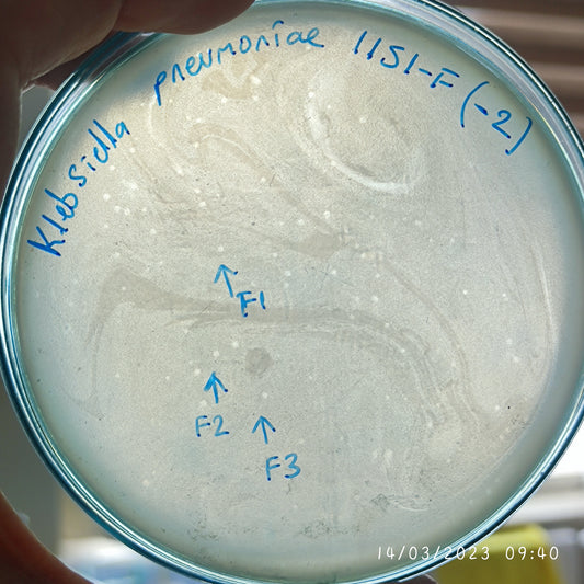 Klebsiella pneumoniae bacteriophage 181151F