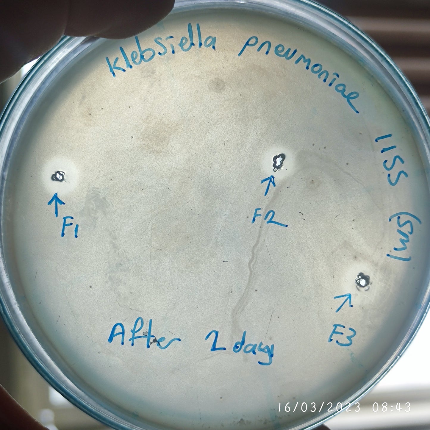 Klebsiella pneumoniae bacteriophage 181155F