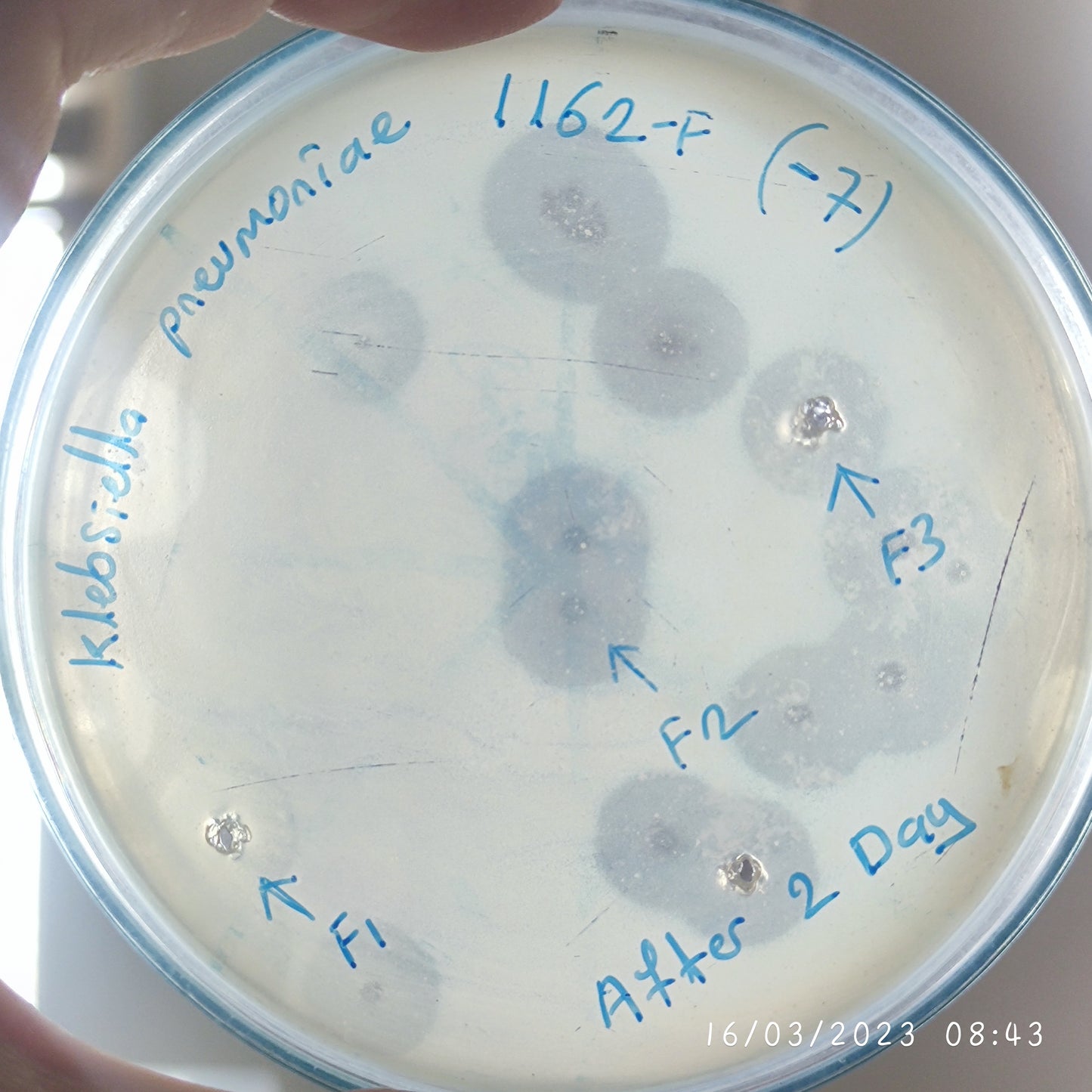 Klebsiella pneumoniae bacteriophage 181162F