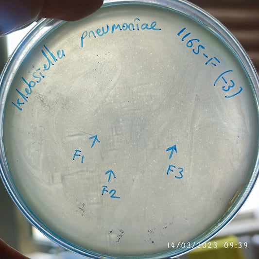 Klebsiella pneumoniae bacteriophage 181165F