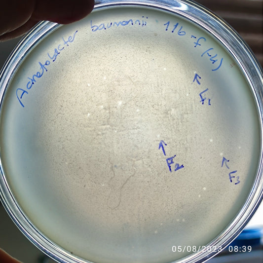 Acinetobacter baumannii bacteriophage 120116F