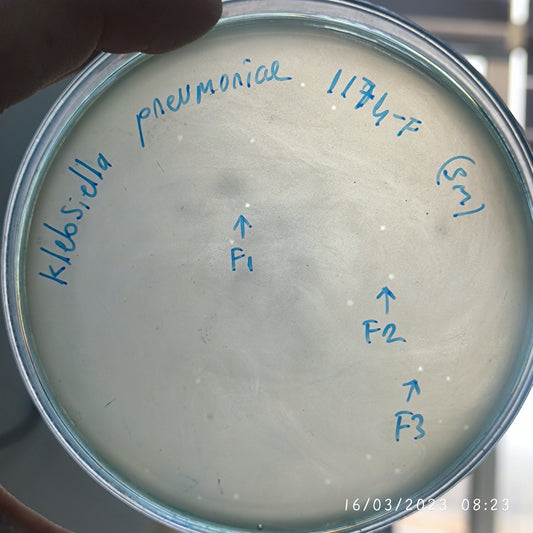 Klebsiella pneumoniae bacteriophage 181174F