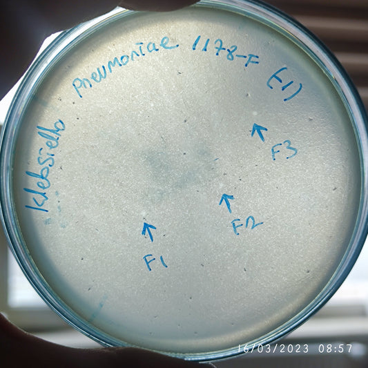 Klebsiella pneumoniae bacteriophage 181178F