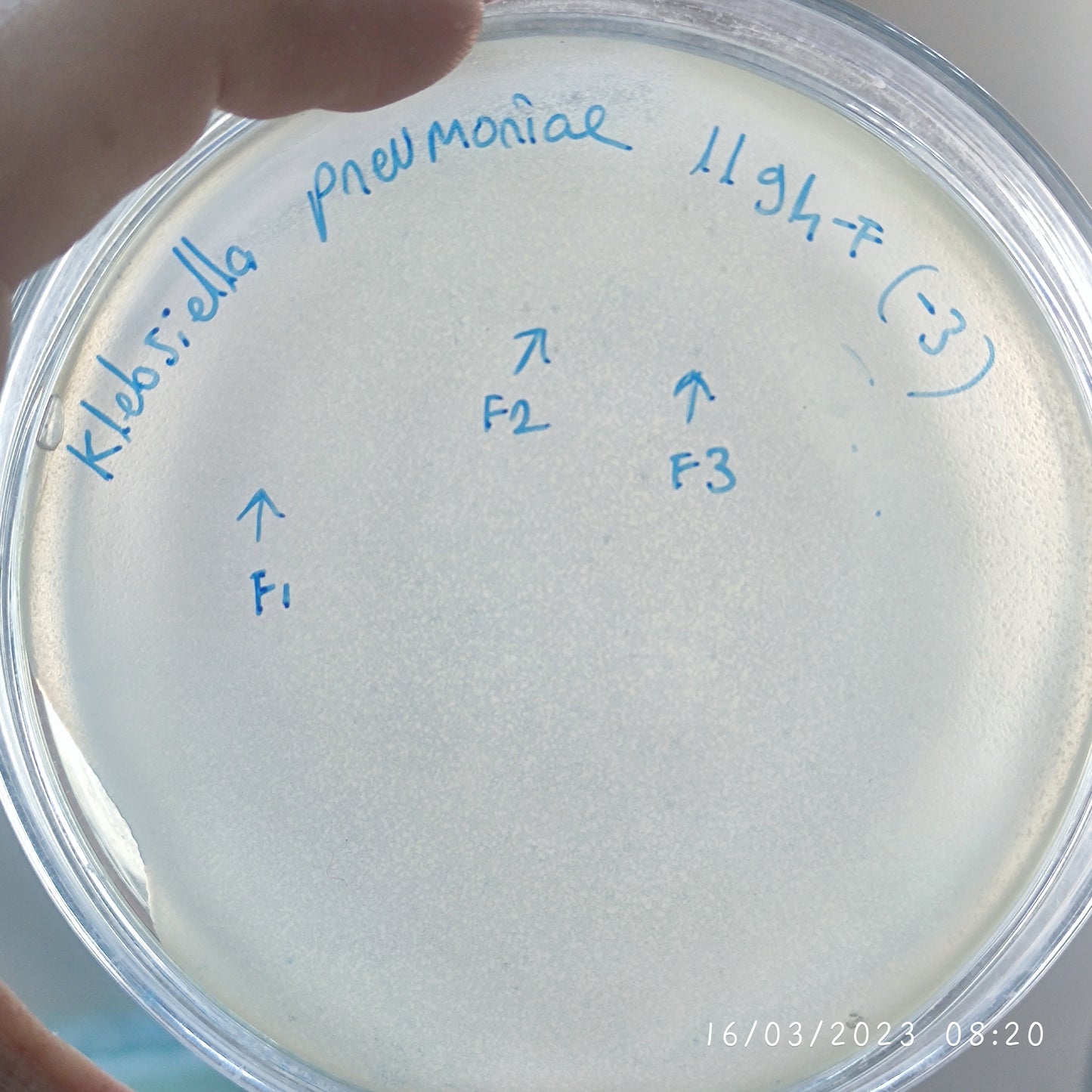 Klebsiella pneumoniae bacteriophage 181194F