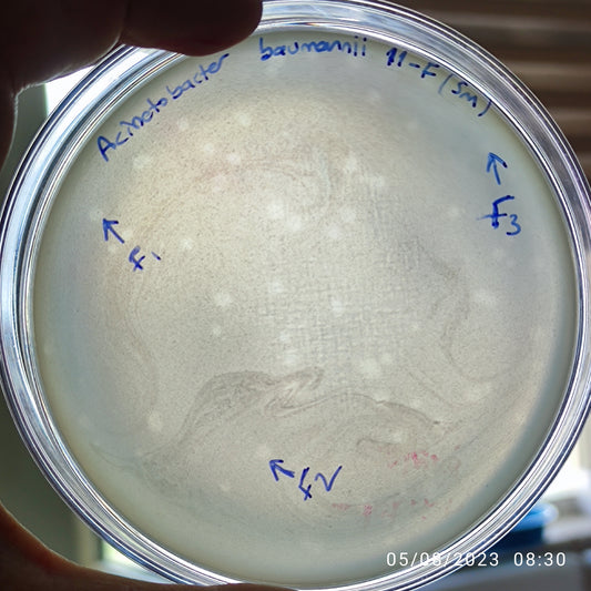 Acinetobacter baumannii bacteriophage 120011F