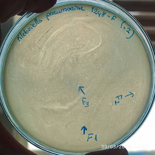 Klebsiella pneumoniae bacteriophage 181248F