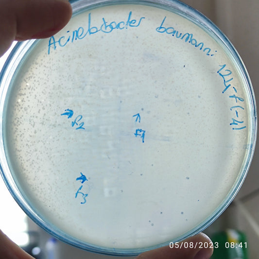 Acinetobacter baumannii bacteriophage 120124F