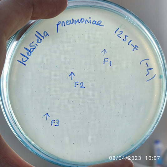 Klebsiella pneumoniae bacteriophage 181251F