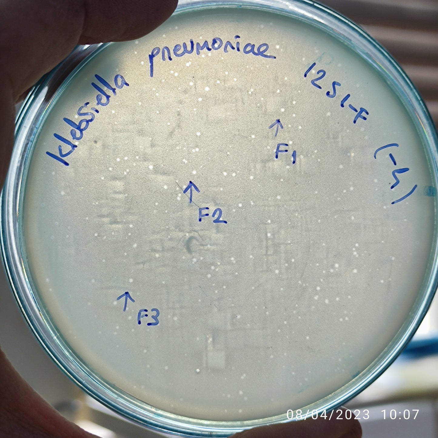 Klebsiella pneumoniae bacteriophage 181251F