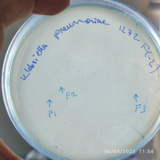 Klebsiella pneumoniae bacteriophage 181272F