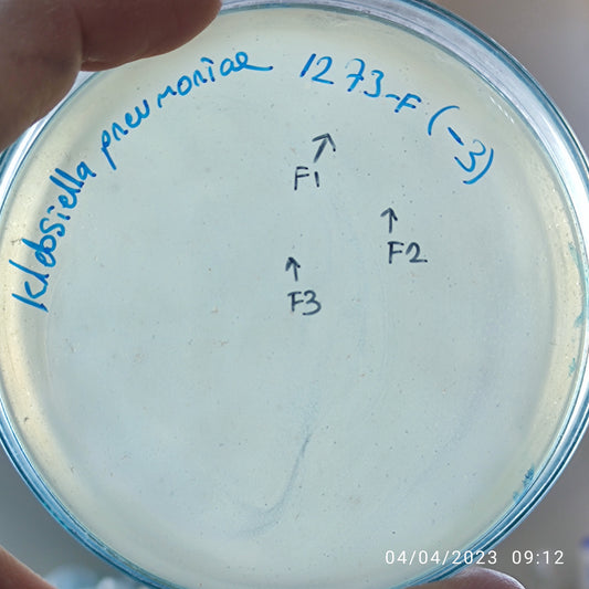 Klebsiella pneumoniae bacteriophage 181273F