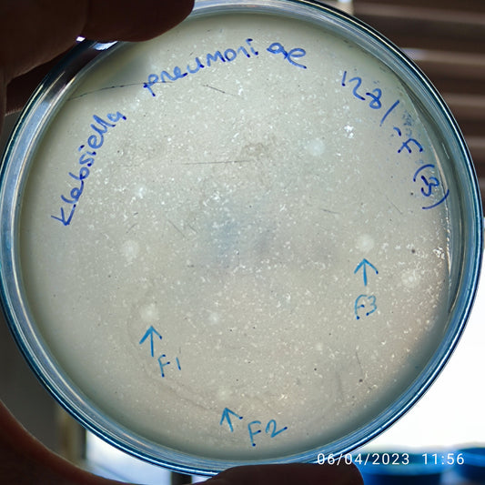 Klebsiella pneumoniae bacteriophage 181281F