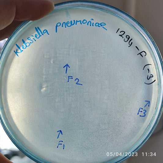 Klebsiella pneumoniae bacteriophage 181294F