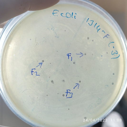 Escherichia coli bacteriophage 101314F