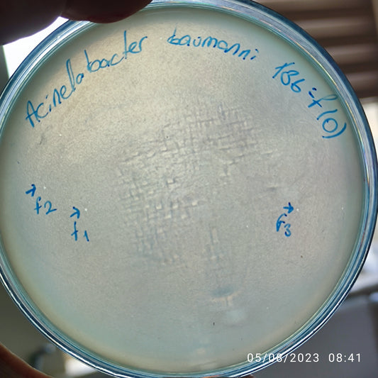 Acinetobacter baumannii bacteriophage 120136F