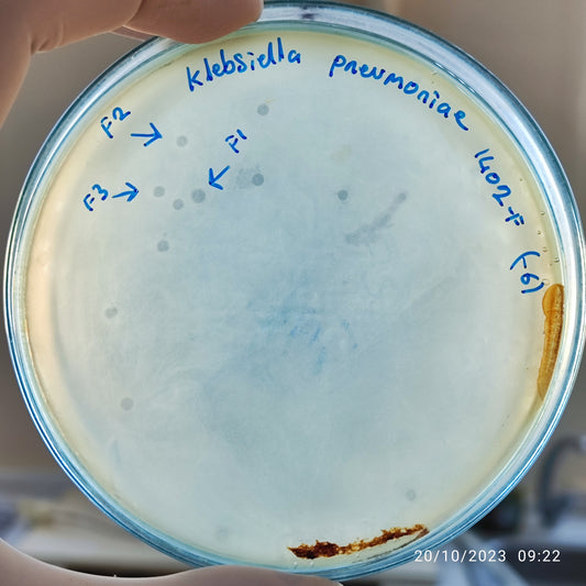 Klebsiella pneumoniae bacteriophage 181402F