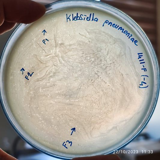 Klebsiella pneumoniae bacteriophage 181411F