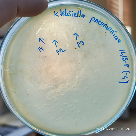 Klebsiella pneumoniae bacteriophage 181415F