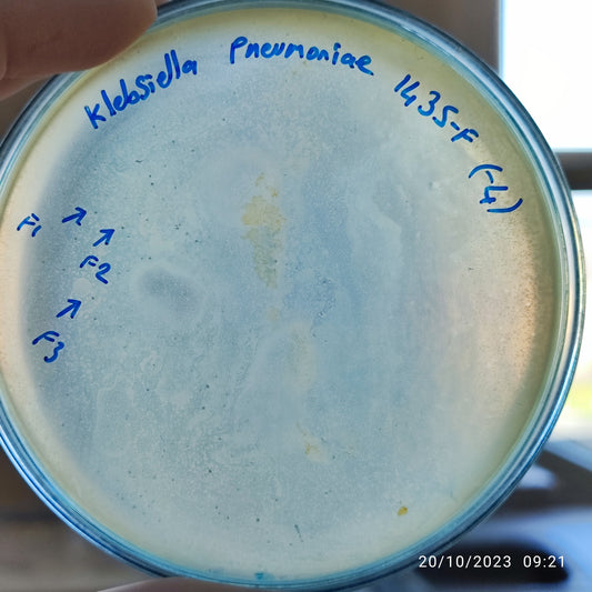 Klebsiella pneumoniae bacteriophage 181435F