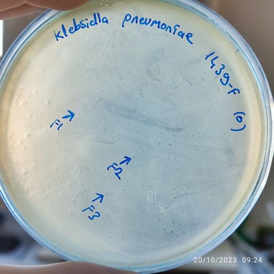 Klebsiella pneumoniae bacteriophage 181439F