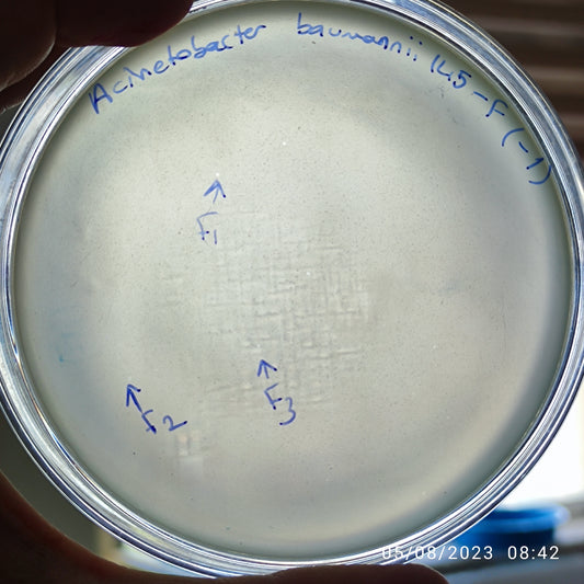 Acinetobacter baumannii bacteriophage 120145F