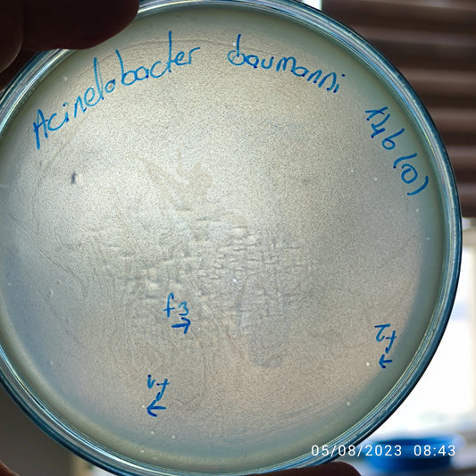 Acinetobacter baumannii bacteriophage 120146F