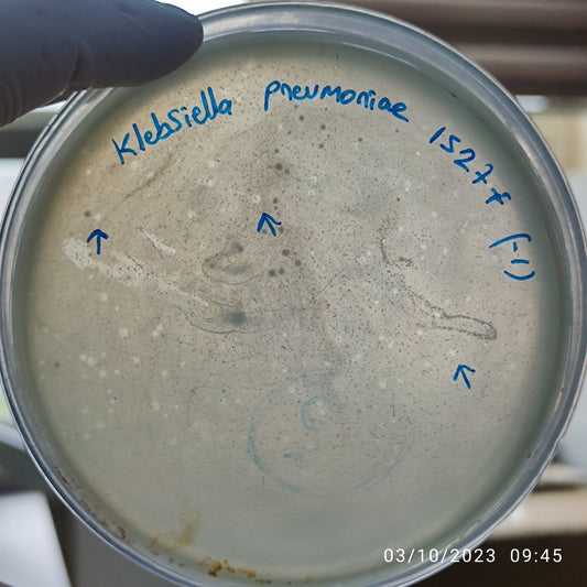 Klebsiella pneumoniae bacteriophage 181527F