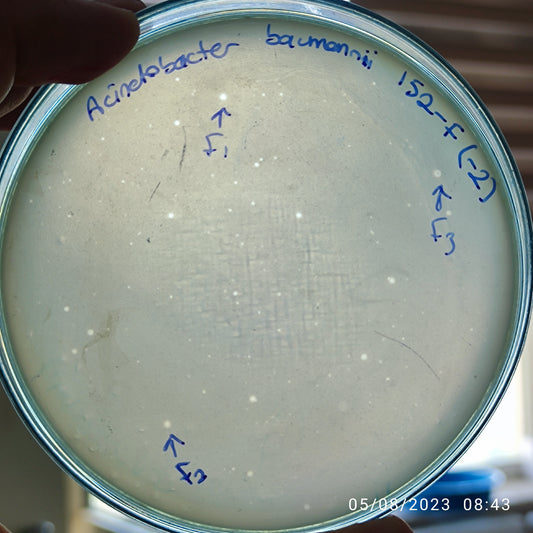 Acinetobacter baumannii bacteriophage 120152F