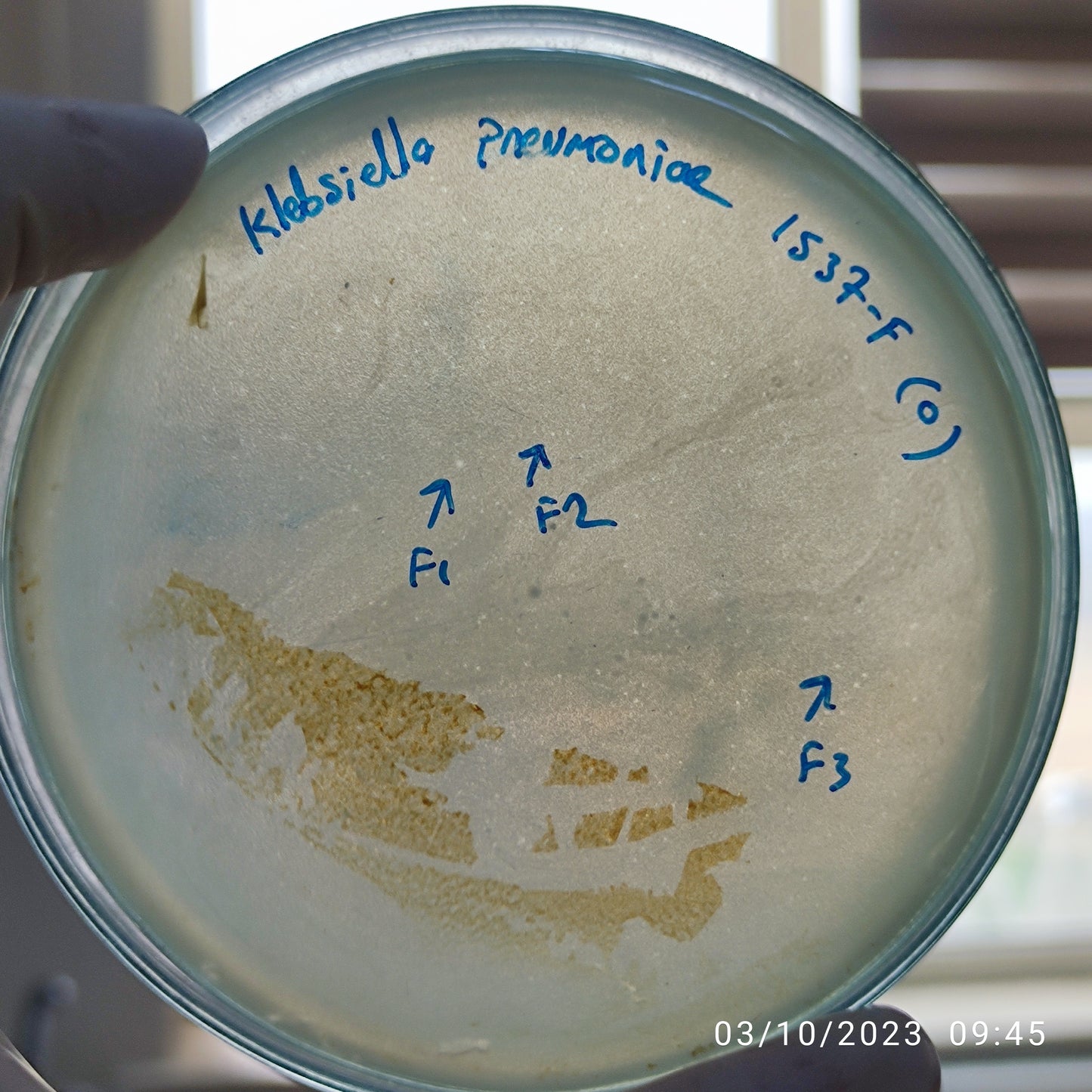 Klebsiella pneumoniae bacteriophage 181537F