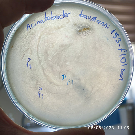 Acinetobacter baumannii bacteriophage 120153F