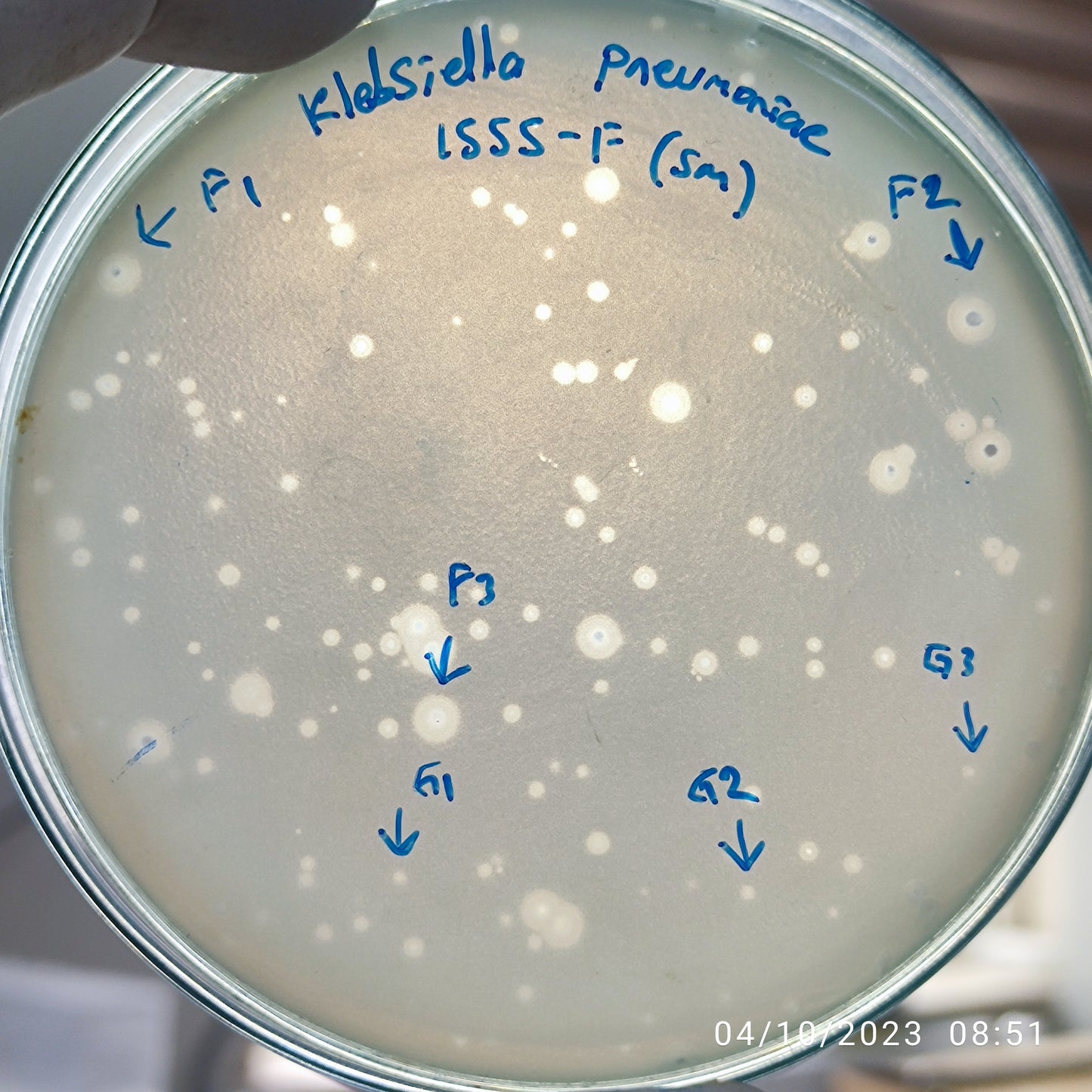 Klebsiella pneumoniae bacteriophage 181555F