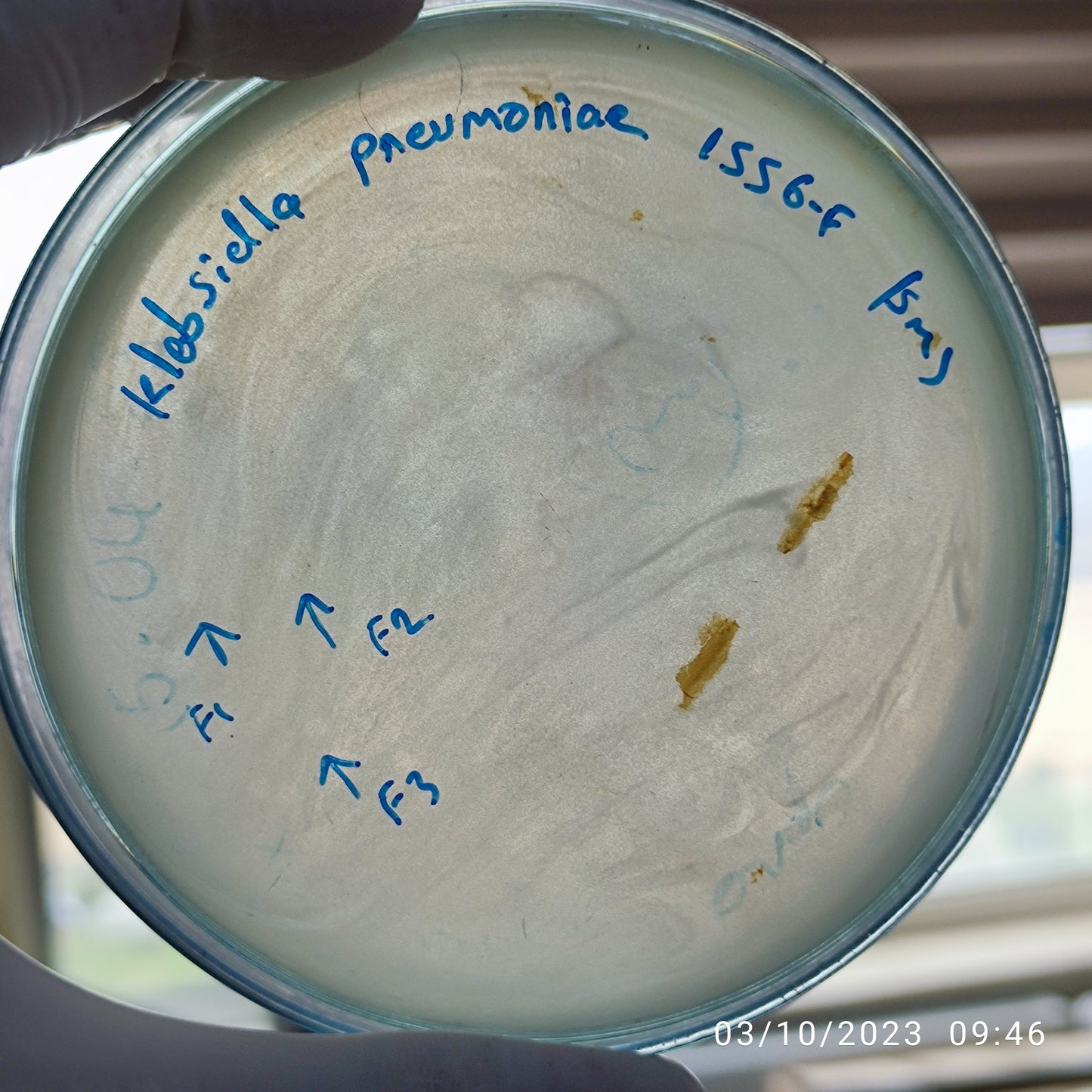 Klebsiella pneumoniae bacteriophage 181556F