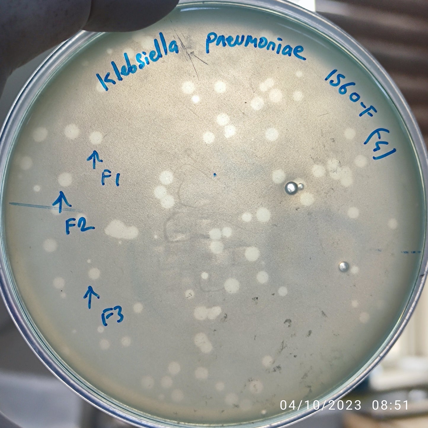 Klebsiella pneumoniae bacteriophage 181560F