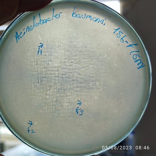 Acinetobacter baumannii bacteriophage 120156F