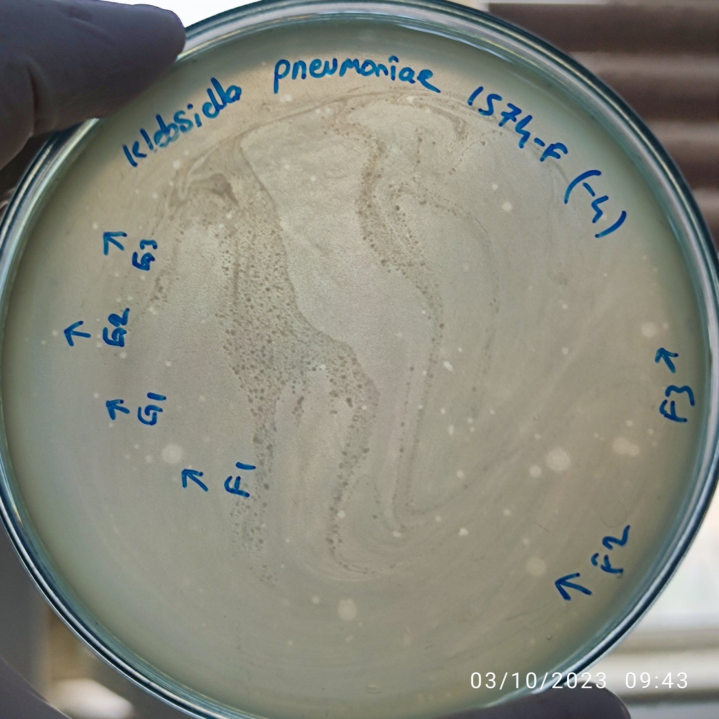 Klebsiella pneumoniae bacteriophage 181574F