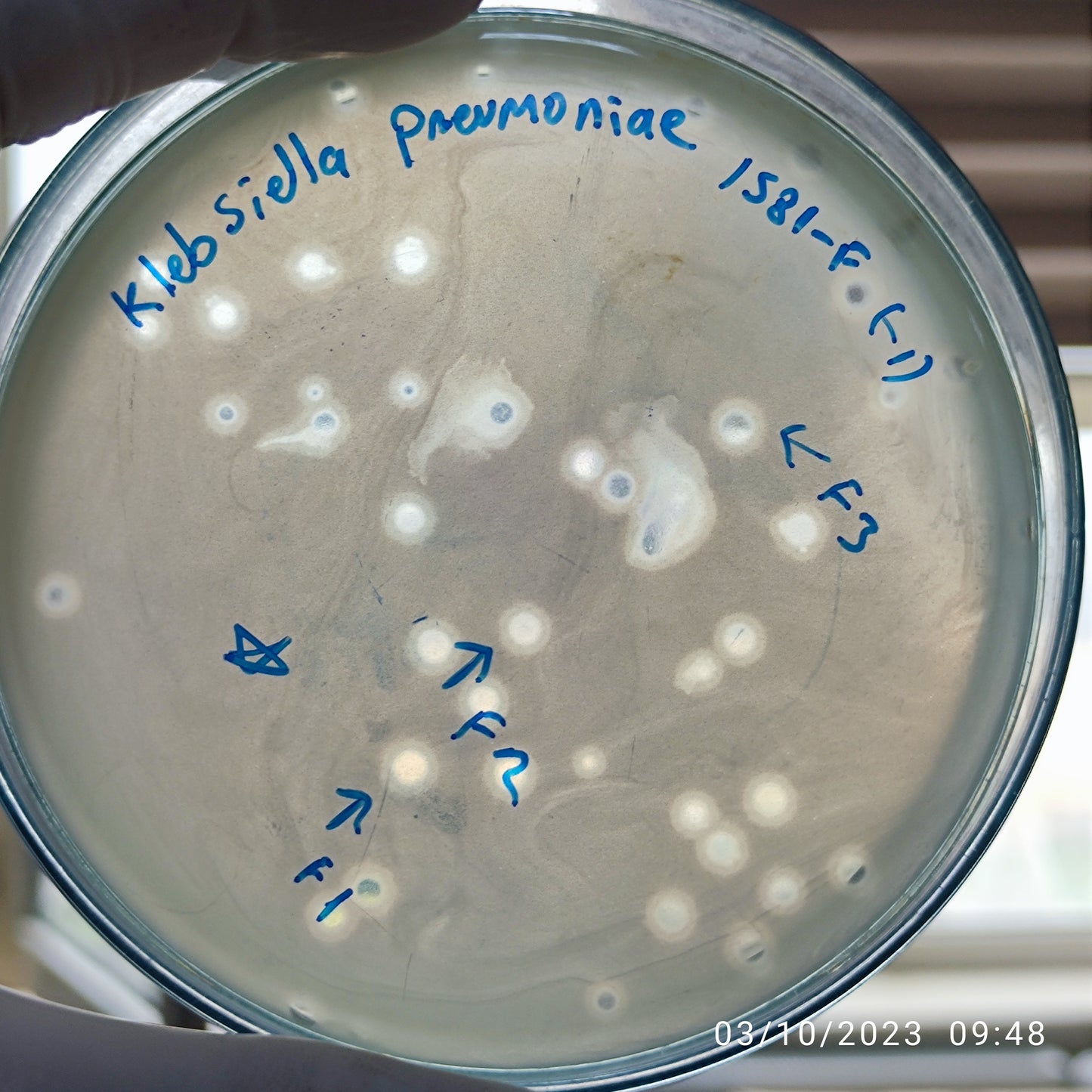 Klebsiella pneumoniae bacteriophage 181581F