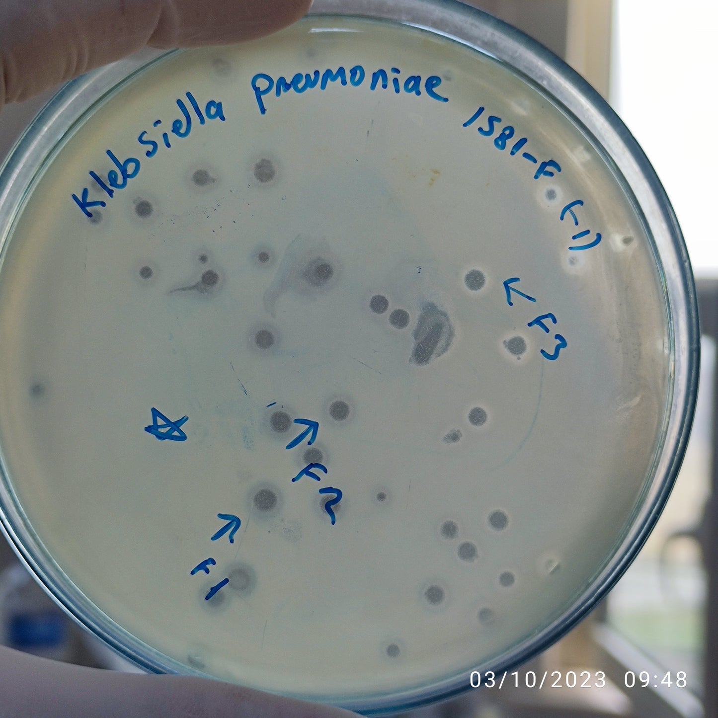 Klebsiella pneumoniae bacteriophage 181581F