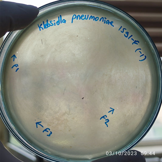 Klebsiella pneumoniae bacteriophage 181591F