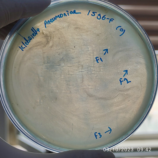Klebsiella pneumoniae bacteriophage 181596F